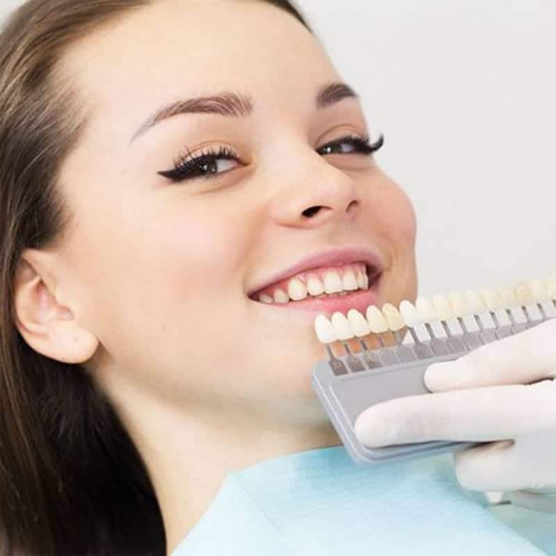 Miller Family Dentistry Chambersburg PA Cosmetic Bonding Services